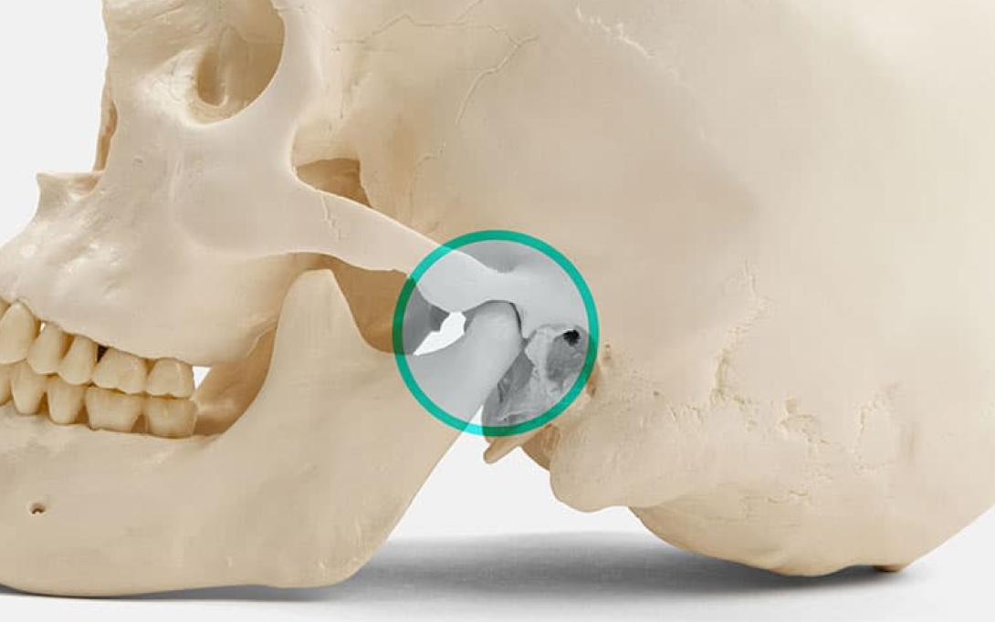 skull with focus point on jaw