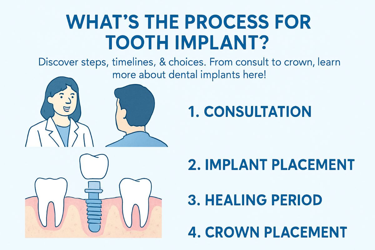 An infographic depicting the step-by-step process for a tooth implant, from initial consultation and exam to healing and final restoration. No text on the image.