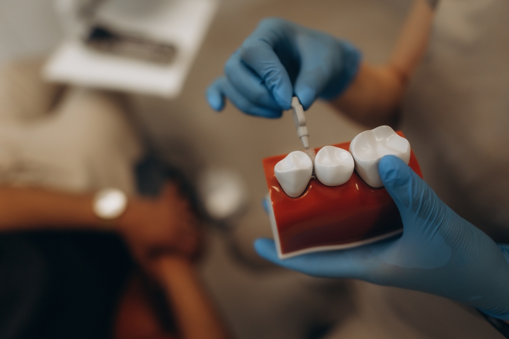 A person in blue gloves holds a dental model displaying three teeth and matches a tooth shade guide to it, indicating a dental consultation about color or prosthetics. A blurred patient sits in the background.